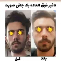 بمب چاقی صورت (پودر جوانه گندم)