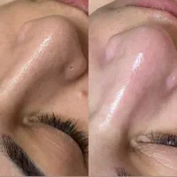 پاکسازی و جوانسازی پوست صورت فقط خانم ها