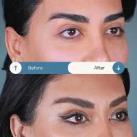 جراحی صورت ۵۰درصد تخفیف|خدمات آرایشگری و زیبایی|تهران, دروس|دیوار