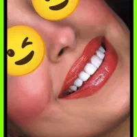 کامپوزیت دندان از دم اقساط در یک جلسه/دندانپزشکی