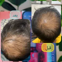 پوست و مو|آرایشی، بهداشتی، درمانی|زبرخان, |دیوار