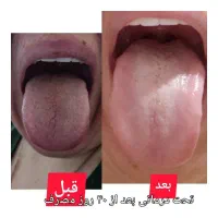 اصلاح مزاج|آرایشی، بهداشتی، درمانی|خرمآباد, |دیوار