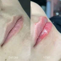 خدمات زیبایی دکتر سجاد جلیلی فرد