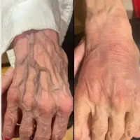 فیلربادی۱۰۰سیسی۱۱تومن باسن هیپ دیپ وآموزش فقط ۷۹۰۰|خدمات آرایشگری و زیبایی|کرج, گوهردشت|دیوار