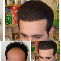 مشاوره مو وپوست