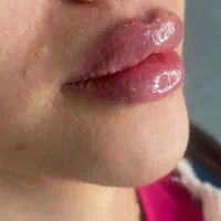 ژل لب