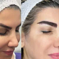 آفر میکروکاشت ابرو نقد و اقساط