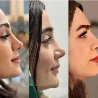 تخفیف ویژه یلدا و روز زن عمل بینی