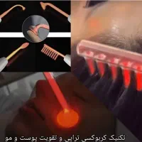 انجام خدمات پوستی هم بانوان و اقایان|خدمات آرایشگری و زیبایی|گرگان, |دیوار