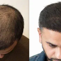 کاشتمو شیراز با شرایط اقساط|خدمات آرایشگری و زیبایی|شیراز, قدوسی شرقی|دیوار