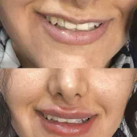 تخفیف ویژه افتتاحیه کلینیک زیبایی دکتر نیک جان|خدمات آرایشگری و زیبایی|رشت, گلسار|دیوار