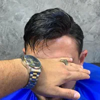 ترمیم و پروتز|خدمات آرایشگری و زیبایی|تبریز, |دیوار