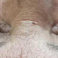 اف ویژه پاکسازی فیشیال*vip* تخصصی درمانی|خدمات آرایشگری و زیبایی|یاسوج, |دیوار