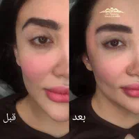 کلنیک زیبایی  لیزر تتو بدن، تزریق ژل و بوتاکس و...|خدمات آرایشگری و زیبایی|اسلام‌شهر, شهرک واوان|دیوار