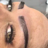 میکروکاشت ابرو بدون جراحی و با جراحی