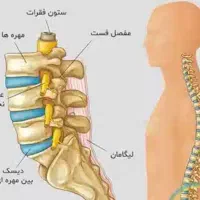 پماد ضد درد