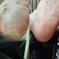 پاهای نرم و بدون ترک، فقط با ۲۹۹ هزار تومان