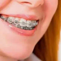 ارتودنسی|خدمات آرایشگری و زیبایی|شیراز, کیان آباد|دیوار