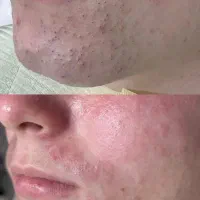 تخفیف ویژه برای یلدا،فشیال و موزو و میکرو و لیفت|خدمات آرایشگری و زیبایی|تهران, تهرانپارس جنوبی|دیوار