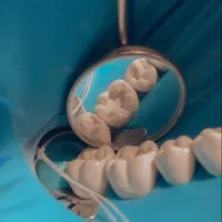 خدمات دندانپزشکی ترمیم و درمان ریشه، زیبایی،اطفال