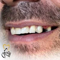 ایمپلنت و خدمات دندانپزشکی