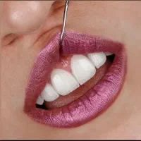 دستیار دندانپزشک