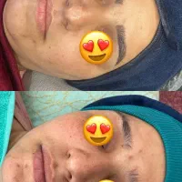 فیشیال و تجویز روتین پوستی اختصاصی رایگان|خدمات آرایشگری و زیبایی|یزد, |دیوار