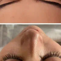 پاکسازی وآبرسانی پوست باتخفیف