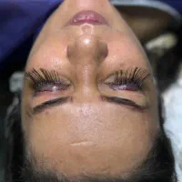 کاشت مژه دائمی با جراحی امکان پرداخت اقساطی