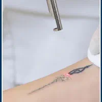 جشنواره یلدایی پاک کردن تتو صورت وبدن بدون آسیب|خدمات آرایشگری و زیبایی|شیراز, فرهنگ شهر|دیوار