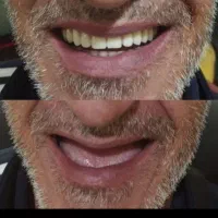 لابراتوار دندانسازی(نیودنت Newdent)|خدمات آرایشگری و زیبایی|کاشمر, |دیوار