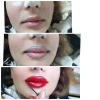 انجام خدمات آرایش دائم و خدمات پوستی