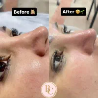 پی آر پی ۱/۵۰۰،فیشال ۵۰۰ تومان