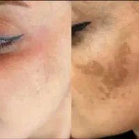 فرصت محدود|آرایشی، بهداشتی، درمانی|مسجد سلیمان, |دیوار