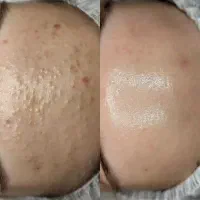 فیشیال پاکسازی صورت آقایان و بانوان * 750 تومان *|خدمات زیبایی و سلامت|تهران, هاشمی|دیوار
