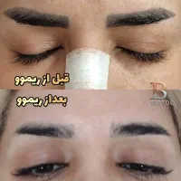 پاک کردن تتوابرو،خطچشم،خطلب(ریموو)|خدمات آرایشگری و زیبایی|شاهین‌شهر, شهرک میلاد|دیوار