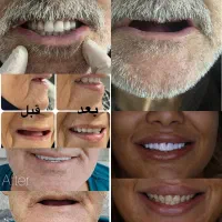 تخفیف خدمات دندانپزشکی زیر تعرفه دولتی