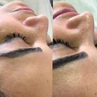 فیشال و پاکسازی پوست محمودآباد