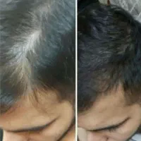 دیگه کاشت نکن