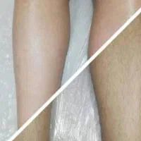 اپلاسیون تخصصی|خدمات آرایشگری و زیبایی|ایرانشهر, |دیوار