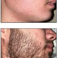 بیا اینجا به پرپشتی ریشات کمک کنم