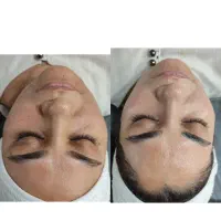 بمب تخفیفات فیشال و خدمات پوستی شروع قیمت از ۱۸۸|خدمات آرایشگری و زیبایی|شیراز, فرگاز|دیوار
