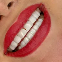 دندان پزشکی/کامپوزیت/روکش