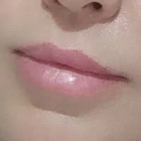 شروع آموزش ژل بوتاکس