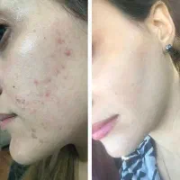 کرم و ارایشی