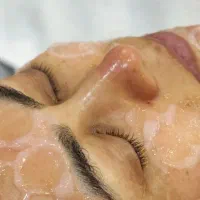 جوانسازی، ابرسانی،پاکسازی صورت (آقا و خانم)|خدمات آرایشگری و زیبایی|نیشابور, امام خمینی|دیوار