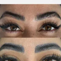 پاک کردن تتوبا لیزر