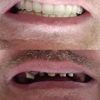 دندانپزشکی با تعرفه دولتی در کرمانشاه