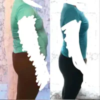 چاقی، لاغری