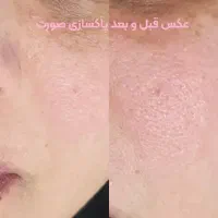 پا.کسازی پوست ۴۸۰|آرایشی، بهداشتی، درمانی|سنندج, |دیوار